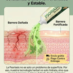 ⭐ PSORIASIS™ | Crema Antifúngica y Antipicazón (20g) ☀️