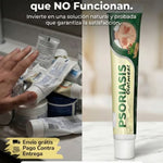 ⭐ PSORIASIS™ | Crema Antifúngica y Antipicazón (20g) ☀️