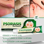 PSORIASIS™ Crema Antifúngica y Antipicazón | 20g ☀️