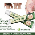 ⭐ PSORIASIS™ | Crema Antifúngica y Antipicazón (20g) ☀️