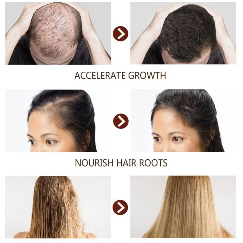 Disaar - Recupera Tu Cabello en 7 Días