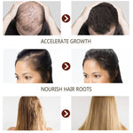 Disaar - Recupera Tu Cabello en 7 Días