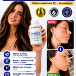 CLEARSTEM™ - SUPLEMENTO HORMONAL PARA ELIMINAR EL ACNÉ DE RAÍZ + ENVÍO GRATIS 🎁