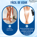 ✨ VARICOSE VEINS™ | Alivio y Cuidado para las Várices 🦵🛡️