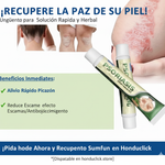 PSORIASIS™ Crema Antifúngica y Antipicazón | 20g ☀️